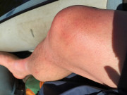 260526_8817i6_ImAllerAltarm_RoteKnie_LanglingenCamp.jpg